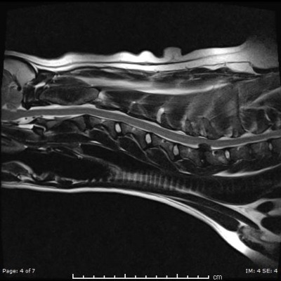 MRI
